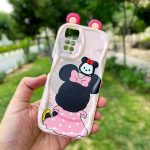 قاب موبایل فانتزی گوش دار میکی موس note 11 / note 11s (قاب های این دو مدل موبایل با هم مشترک هستند )